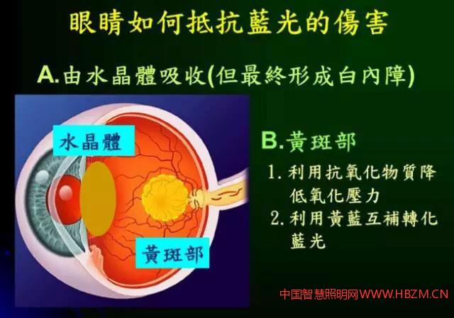 图1早发性白内障