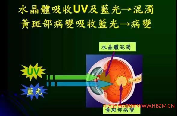 图2黄斑部病变